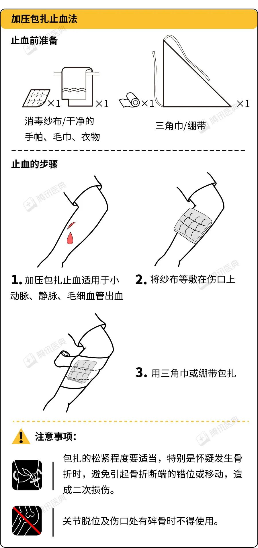 止血带轮扎四肢图片图片